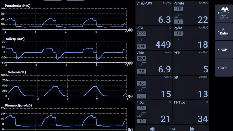 designed-for-protective-ventilation